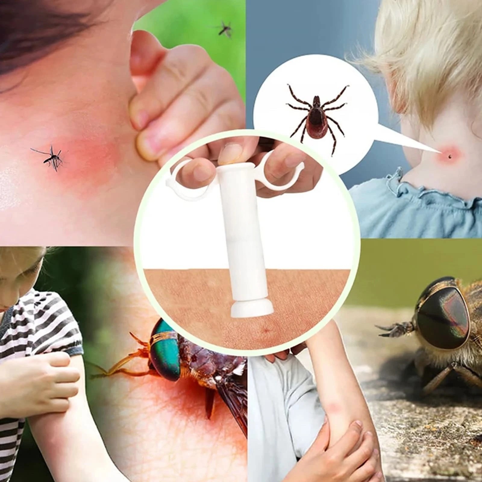 Bug Bite Suction Tool Venom Extractor Itch Relief First Aid Kit for Mosquito Bee